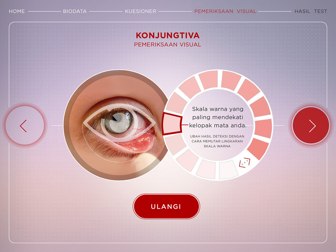 anemiameter eye hasil deteksi old